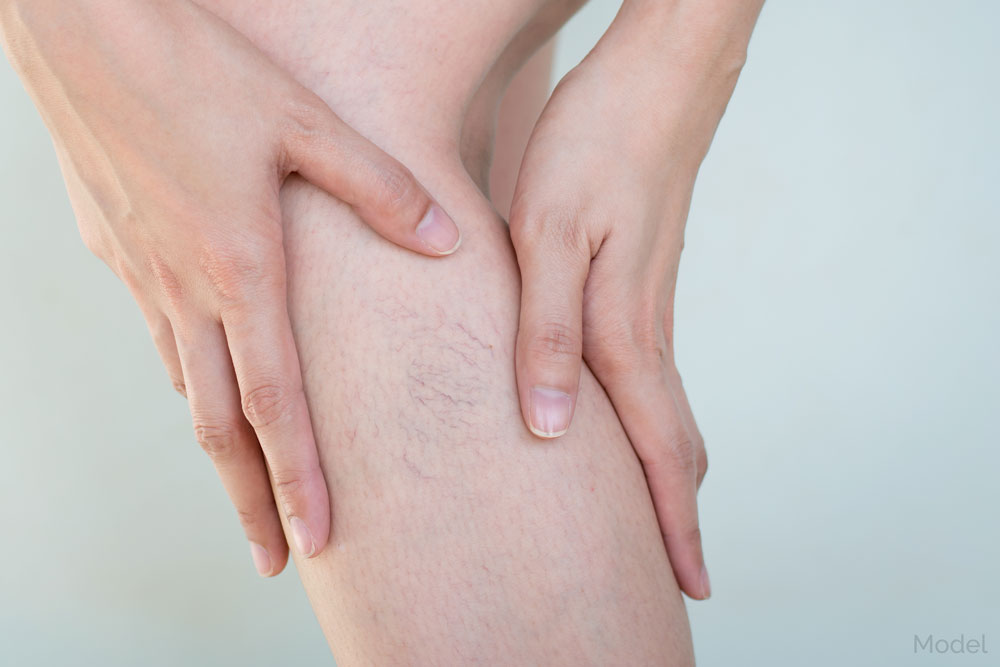 Close up of hands rubbing their calf with slight veins showing in the skin